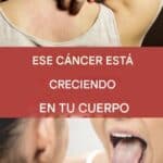 19 señales de advertencia de que el cáncer está creciendo en su cuerpo