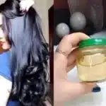 Frena la Caída del Cabello y nace nuevo
