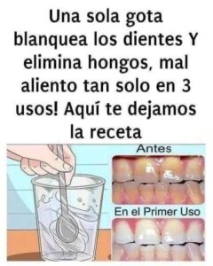 Quita el sarro de tus dientes y blanquéalos: Receta Casera Infalible. 2 Quita el sarro de tus dientes y blanquéalos