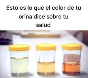 Lo que dice el color de tu orina sobre tu salud: guía completa 2 Lo que dice el color de tu orina sobre tu salud