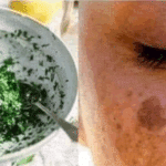 Mascarilla casera de perejil para las arrugas y manchas