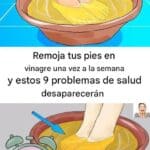 Remoja tus pies en vinagre una vez a la semana y observa cómo desaparecen estos 9 problemas de salud