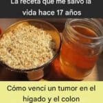 Superé tumores de hígado y colon hace 17 años con esta receta