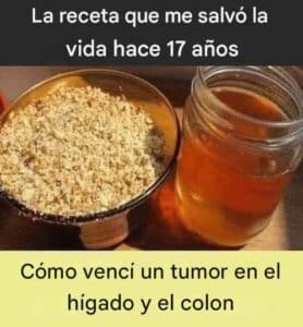 Superé tumores de hígado y colon hace 17 años con esta receta