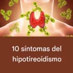10 síntomas de hipotiroidismo