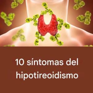 10 síntomas de hipotiroidismo: Descubre las señales de alerta 2 10 síntomas de hipotiroidismo