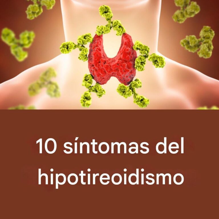 10 síntomas de hipotiroidismo