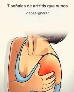 7 señales de advertencia de artritis que no debes ignorar 2 7 señales de advertencia de artritis