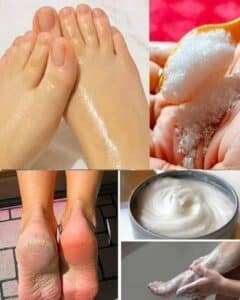 Aquí se explica cómo hacer una pedicura en casa: El tratamiento con bicarbonato de sodio 2 Aquí se explica cómo hacer una pedicura en casa