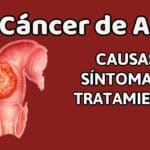 Cáncer de colon