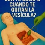 Que sucede con tu cuerpo cuando te quitan la vesícula