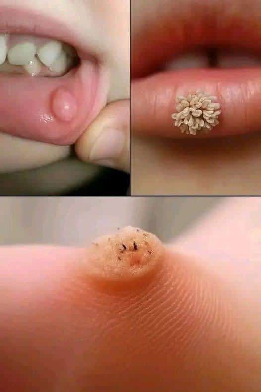 Estos son los primeros signos de un enf