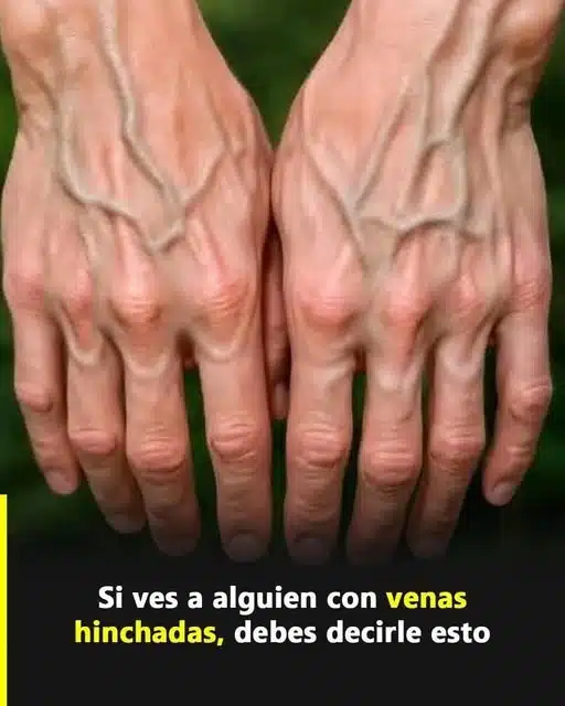 Venas Visibles en Manos: Genética, Grasa, Ejercicio y Edad 2 700